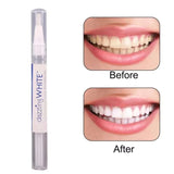 Home Square Natural Teeth Whitening Gel Pen In Pakistan